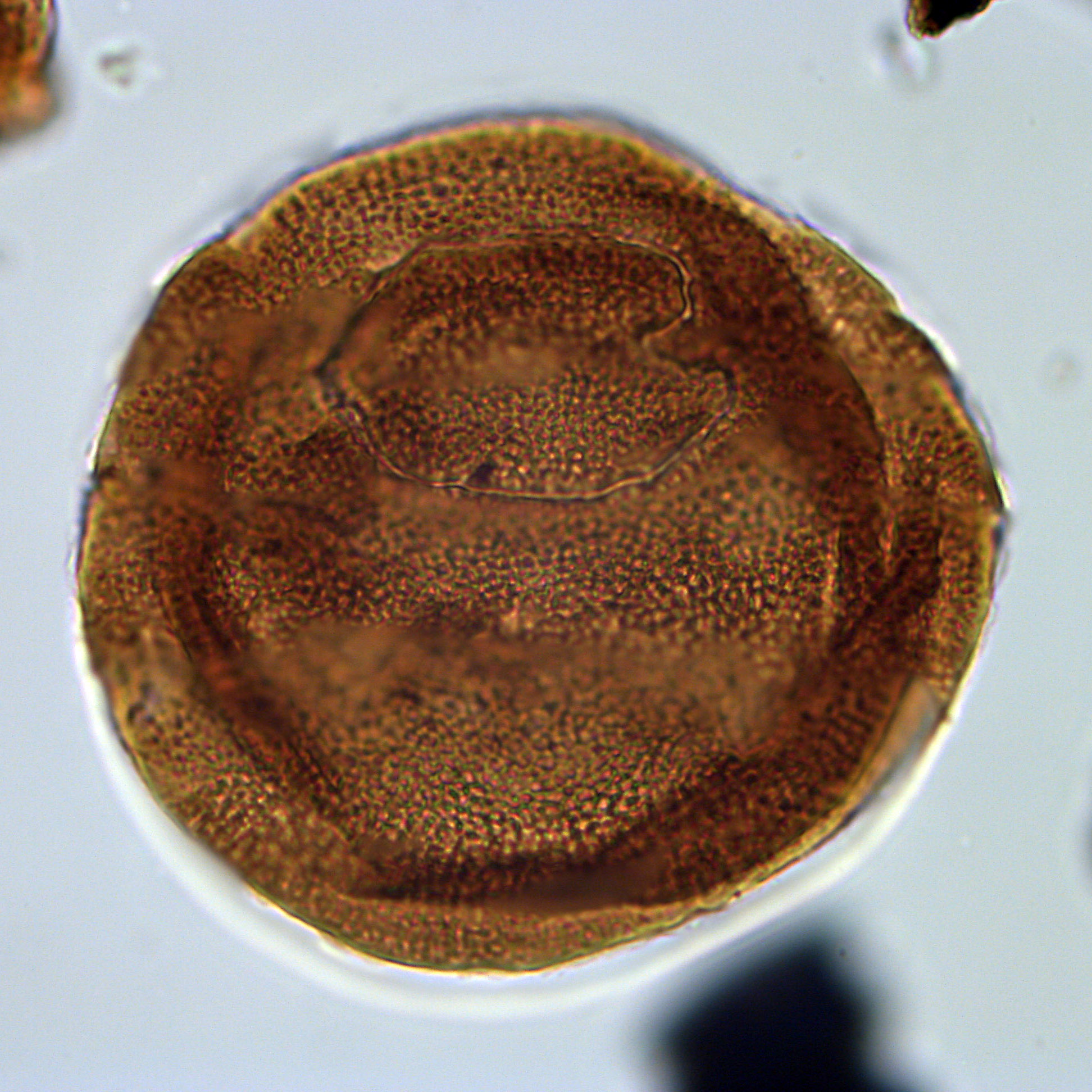 Batiacasphaera euteiches, U1581-30R-3W, 74-78, sl. 1, O26-4.jpg